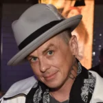 Slipknot’s Sid Wilson Sustains Burns in Accident